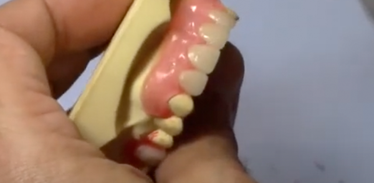 lingual-wax-application-2